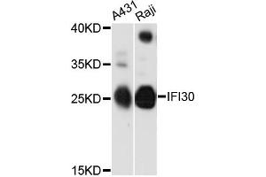 Western blot analysis of extracts of various cell lines, using IFI30 antibody (ABIN6293143) at 1:3000 dilution.