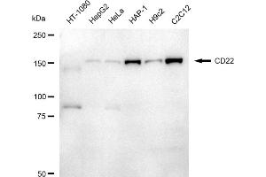 Western blotting analysis using CD22 antibody (ABIN7797958). (Recombinant CD22 抗体)