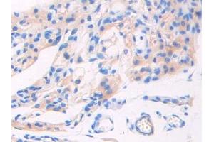 Used in DAB staining on fromalin fixed paraffin- embedded pancreas tissue (GAD 抗体  (AA 1-97))
