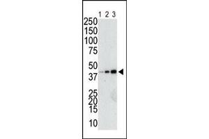 The anti-GST Pab (ABIN388090 and ABIN2843198) is used in Western blot to detect a GST-fusion recombinant protein (42 kDa) purified from bacterial lysate (Lanes 1-3: 10, 40, and 160 ng GST-fusion protein). (GST-Tag 抗体)