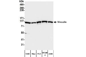 Western Blotting (WB) image for anti-Vinculin (VCL) (AA 1016-1066) antibody (ABIN7454836) (Vinculin 抗体  (AA 1016-1066))