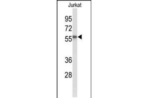 Western blot analysis of SACM1L Antibody in Jurkat cell line lysates (35ug/lane) (SACM1L 抗体  (C-Term))