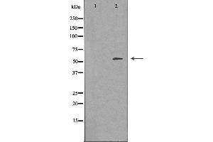 Western blot analysis of extracts from Jurkat cells, using FRK antibody. (FRK 抗体  (Internal Region))