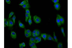 Immunofluorescence staining of HepG2 cells with ABIN7149663 at 1:66, counter-stained with DAPI. (Transmembrane 7 Superfamily Member 4 (TM7SF4) (AA 119-209) 抗体)