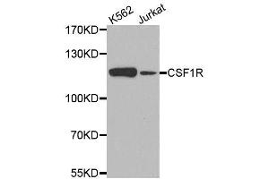 Western blot analysis of extracts of various cell lines, using CSF1R antibody. (CSF1R 抗体)