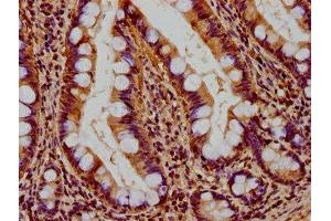 IHC image of ABIN7159941 diluted at 1:400 and staining in paraffin-embedded human small intestine tissue performed on a Leica BondTM system. (RHOT2 抗体  (AA 84-300))