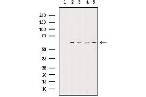 Western blot analysis of extracts from various samples, using TIGD2 Antibody. (TIGD2 抗体)