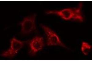 ABIN6275089 staining HeLa cells by IF/ICC. (MYLIP 抗体  (Internal Region))