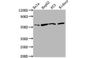 Western Blot Positive WB detected in: Hela whole cell lysate, HepG2 whole cell lysate, PC-3 whole cell lysate, Rat kidney tissue All lanes: TTI2 antibody at 8. (TTI2 抗体  (AA 159-264))