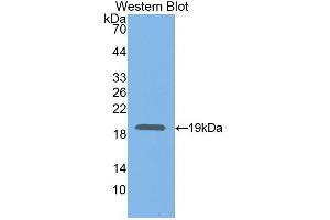 Western blot analysis of the recombinant protein. (Neuregulin 1 抗体  (AA 328-486))