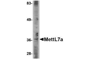Image no. 1 for anti-Methyltransferase Like 7A (METTL7A) (C-Term) antibody (ABIN341690) (METTL7A 抗体  (C-Term))