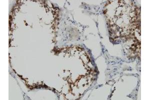 Image no. 1 for anti-POM121 and ZP3 Fusion (POMZP3) (AA 64-116) antibody (ABIN599186) (POMZP3 抗体  (AA 64-116))