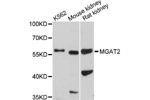 Western blot analysis of extracts of various cell lines, using MGAT2 antibody. (MGAT2 抗体)