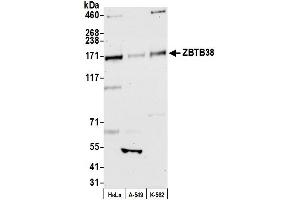 anti-Zinc Finger and BTB Domain Containing 38 (ZBTB38) (AA 200-250) antibody