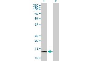 Western Blot analysis of ACOT13 expression in transfected 293T cell line by ACOT13 MaxPab polyclonal antibody. (THEM2 抗体  (AA 1-140))