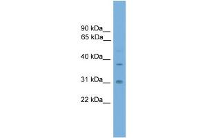 WB Suggested Anti-AIP Antibody Titration: 0. (AIP 抗体  (Middle Region))