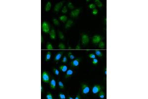Immunofluorescence analysis of MCF7 cell using UCP3 antibody. (UCP3 抗体)