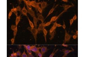 Immunofluorescence analysis of NIH/3T3 cells using UBQLNL Polyclonal Antibody at dilution of 1:100. (UBQLNL 抗体)