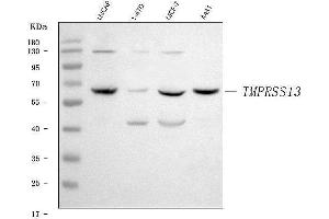 Western blot analysis of TMPRSS13 using anti-TMPRSS13 antibody (ABIN7599797).