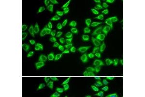 Immunofluorescence analysis of A549 cells using HADHB Polyclonal Antibody (HADHB 抗体)