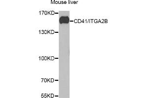 Western blot analysis of extracts of mouse liver, using CD41/CD41/ITGB antibody (ABIN6129287, ABIN6142560, ABIN6142562 and ABIN6221333) at 1:1000 dilution. (Integrin Alpha2b 抗体  (AA 693-993))