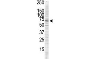 Western Blotting (WB) image for anti-Calcium/calmodulin-Dependent Protein Kinase II delta (CAMK2D) antibody (ABIN5023065) (CAMK2D 抗体)