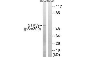 Western blot analysis of extracts from COLO cells using STK39 (Phospho-Ser309) Antibody. (STK39 抗体  (pSer311))