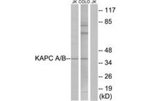 Western blot analysis of extracts from COLO/Jurkat cells, using KAPC A/B Antibody. (KAPC A/B (AA 1-50) 抗体)