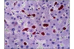 Human Liver: Formalin-Fixed, Paraffin-Embedded (FFPE) (HGS 抗体  (Internal Region))