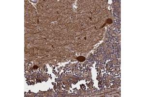 Immunohistochemical staining of human cerebellum with PLP2 polyclonal antibody  shows strong cytoplasmic positivity in purkinje cells at 1:50-1:200 dilution. (PLP2 抗体)