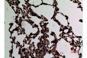 Immunohistochemistry (IHC) analysis of paraffin-embedded Rat Lung, antibody was diluted at 1:100.