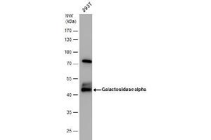 WB Image Galactosidase alpha antibody detects Galactosidase alpha protein by western blot analysis.