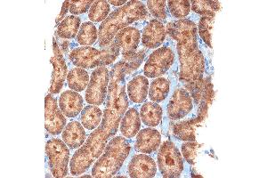 Immunohistochemistry of paraffin-embedded rat kidney using NEK6 Rabbit mAb (ABIN7268916) at dilution of 1:100 (40x lens). (NEK6 抗体)