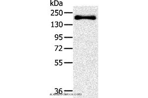 Western blot analysis of Mouse bladder tissue, using SLIT2 Polyclonal Antibody at dilution of 1:200 (SLIT2 抗体)