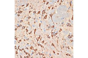 Immunohistochemistry of paraffin-embedded rat brain using Musashi-2 (Musashi-2 (MSI2)) Rabbit mAb (ABIN7268701) at dilution of 1:100 (40x lens). (MSI2 抗体)