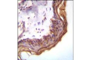 Immunohistochemical staining of formalin fixed and paraffin embedded human skin was performed with KLK7 polyclonal antibody  at 1:10-1:50 dilution followed by indirect peroxidase conjugation with secondary antibody and DAB staining.