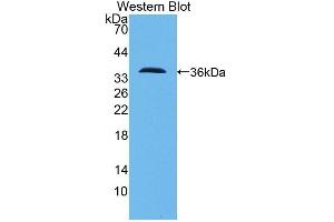 Detection of Recombinant PCNT, Human using Polyclonal Antibody to Pericentrin (PCNT) (PCNT 抗体  (AA 2987-3246))