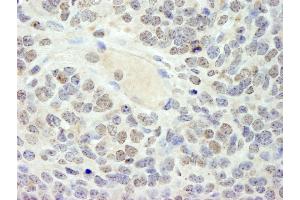 Immunohistochemistry (IHC) image for anti-High Mobility Group Box 3 (HMGB3) (AA 125-175) antibody (ABIN7448596) (HMGB3 抗体  (AA 125-175))