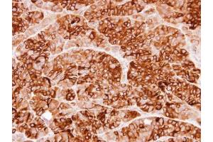 IHC-P Image Immunohistochemical analysis of paraffin-embedded SW480 xenograft, using Cystatin S, antibody at 1:100 dilution. (CST4 抗体  (N-Term))