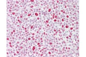 Anti-PSME3 antibody IHC of human tonsil. (PSME3 抗体  (AA 48-97))