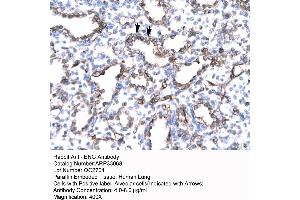 Human Lung (Endoglin 抗体  (N-Term))