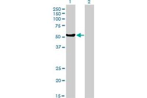 Western Blotting (WB) image for anti-MutY Homolog (E. Coli) (MUTYH) (AA 436-535) antibody (ABIN561883)
