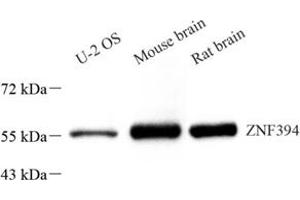 Western blot analysis of ZNF394 (ABIN7076266) at dilution of 1: 1500 (ZNF394 抗体)