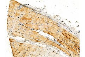 Phospho-OTUB1 (Ser16) Antibody at 1/100 staining Rat skin tissue by IHC-P. (OTUB1 抗体  (pSer16))