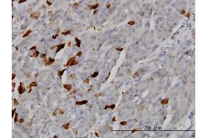 Immunoperoxidase of monoclonal antibody to TSSK2 on formalin-fixed paraffin-embedded human pancreas. (TSSK2 抗体  (AA 265-358))