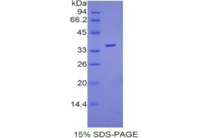 SDS-PAGE analysis of Mouse Coagulation Factor V Protein. (Coagulation Factor V Protein (F5))
