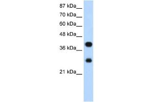WB Suggested Anti-PCBP2 Antibody Titration:  1. (PCBP2 抗体  (Middle Region))
