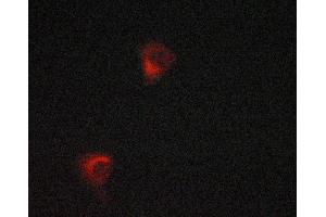 ABIN6268921 staining LOVO cells by ICC/IF.