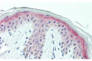 Detection of CSPG4 in Human Skin Tissue using Polyclonal Antibody to Chondroitin Sulfate Proteoglycan 4 (CSPG4) (NG2 抗体  (AA 1919-2258))