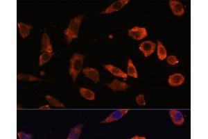 Immunofluorescence analysis of L929 cells using RAB5B Polyclonal Antibody at dilution of 1:100. (RAB5B 抗体)